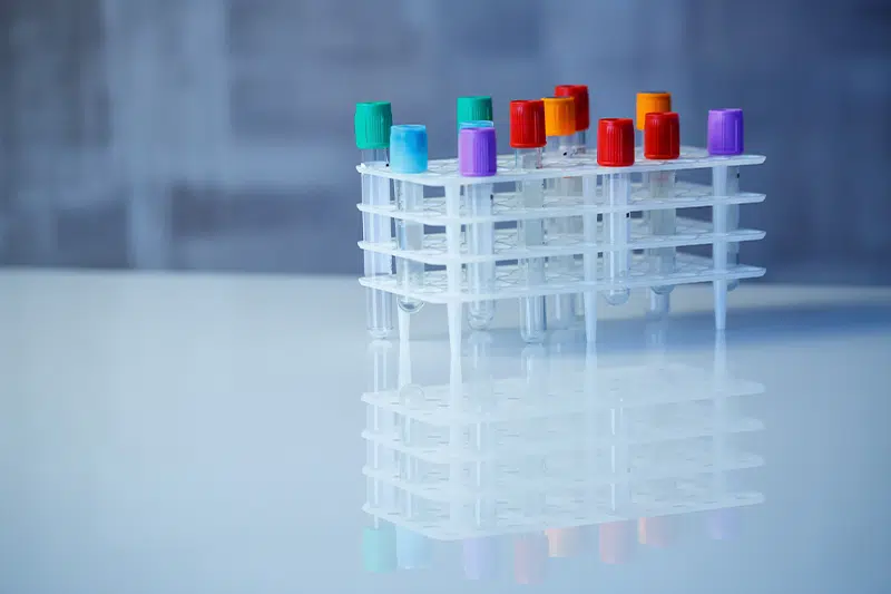 Muestras de ADN en tarjetas GenSaver | ZOGBI