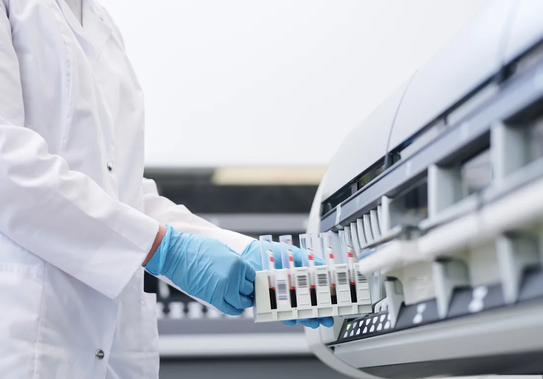 HPLC: qué es, cómo funciona y aplicaciones | ZOGBI
