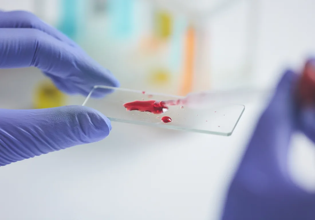 Hematología forense: qué es, ramas y análisis | Zogbi